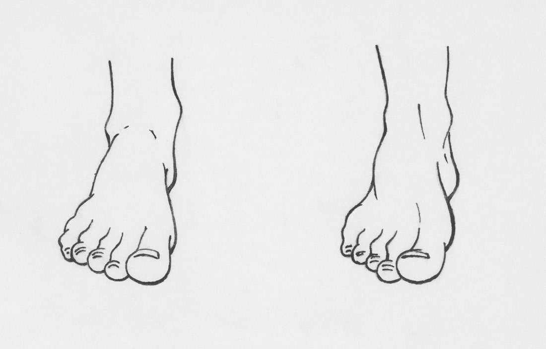 Why Your Feet Hurt When Walking: How Insoles Can Help Blissoles